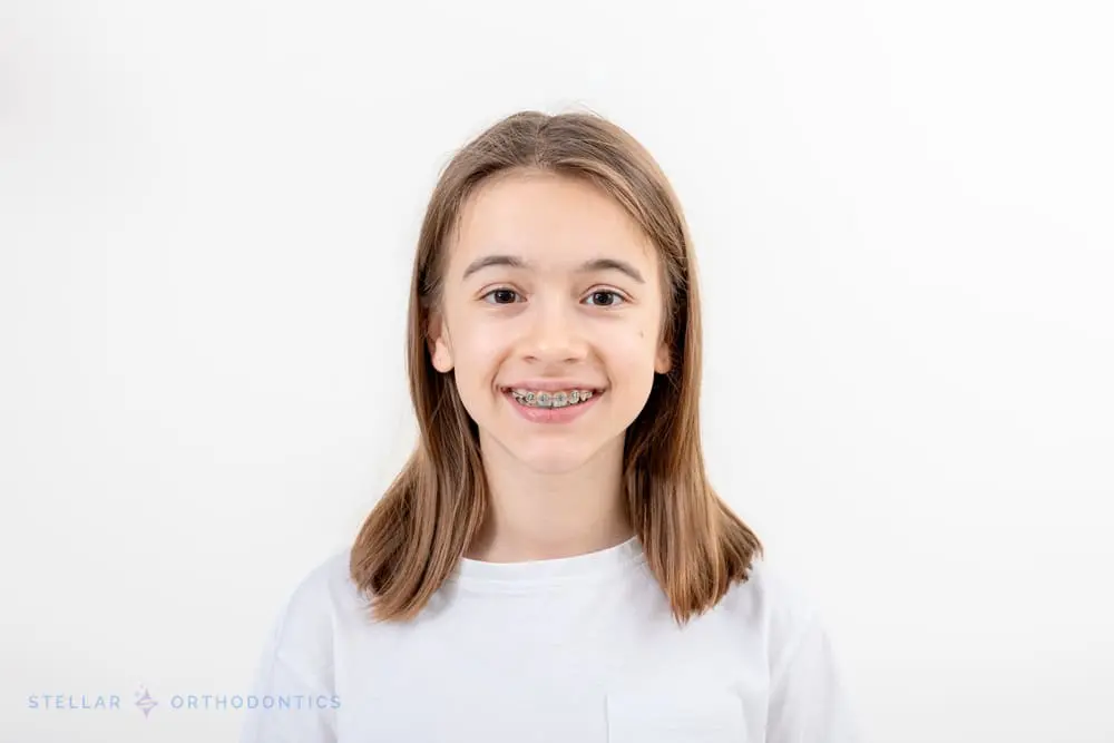 A smiling child with straight brown hair, wearing braces and a white T-shirt, stands against a plain white background—representing the results achieved at Stellar Orthodontics' braces for overbite in San Marcos, CA.