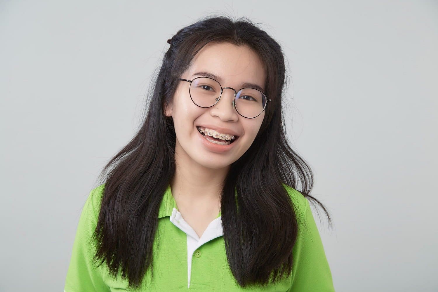 Smiling young woman with metal braces and glasses in a green collared shirt, representing Stellar Orthodontics in San Marcos, CA.